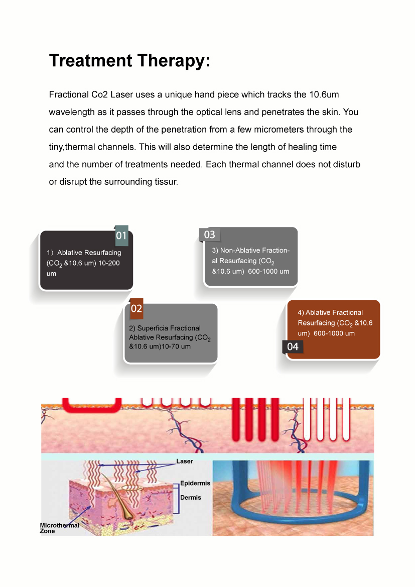 KM Vaginal Tightening Co2 Fractional Laser Machine Acne Scar Removal Skin Resurfacing CO2 Laser Scar Removal Whitening CO2 Laser KM Vaginal Tightening Co2 Fractional Laser Machine Acne Scar Removal Skin Resurfacing CO2 Laser Scar Removal Whitening CO2 Laser