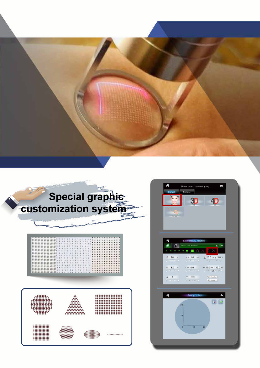 KM Vaginal Tightening Co2 Fractional Laser Machine Acne Scar Removal Skin Resurfacing CO2 Laser Scar Removal Whitening CO2 Laser KM Vaginal Tightening Co2 Fractional Laser Machine Acne Scar Removal Skin Resurfacing CO2 Laser Scar Removal Whitening CO2 Laser