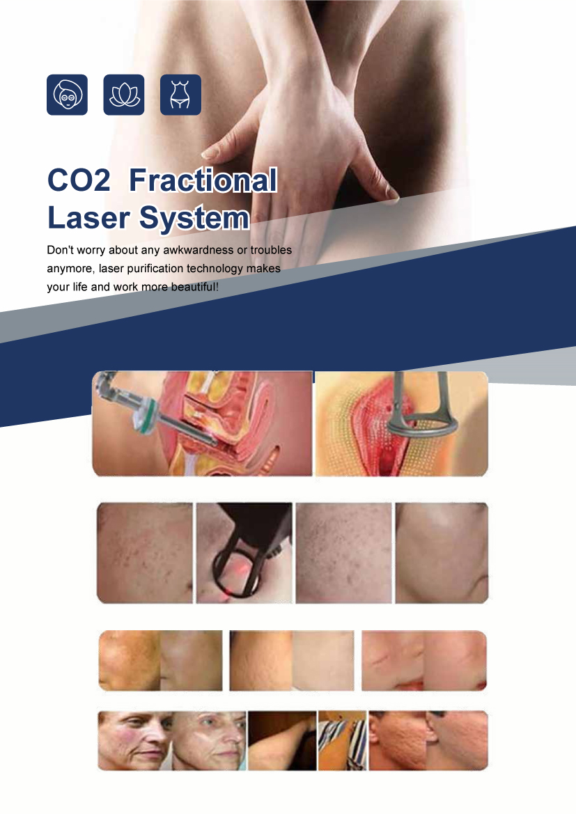 KM Vaginal Tightening Co2 Fractional Laser Machine Acne Scar Removal Skin Resurfacing CO2 Laser Scar Removal Whitening CO2 Laser KM Vaginal Tightening Co2 Fractional Laser Machine Acne Scar Removal Skin Resurfacing CO2 Laser Scar Removal Whitening CO2 Laser