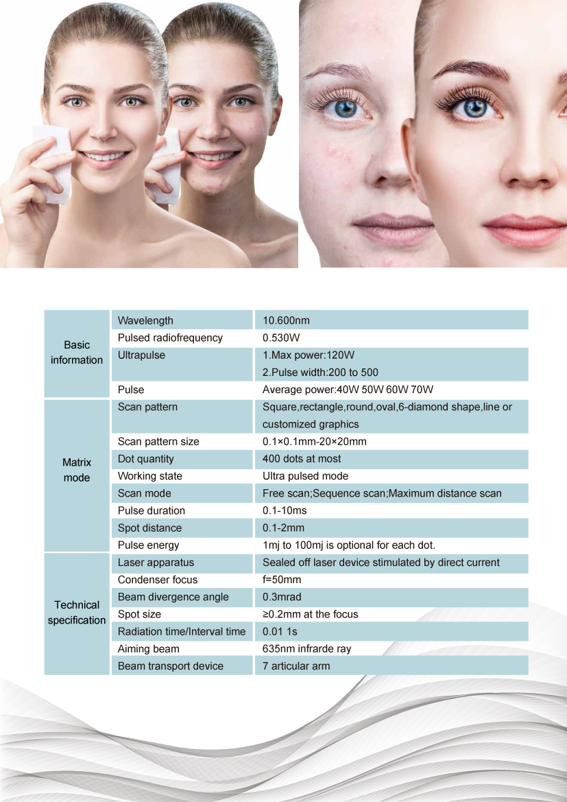 KM Vaginal Tightening Co2 Fractional Laser Machine Acne Scar Removal Skin Resurfacing CO2 Laser Scar Removal Whitening CO2 Laser KM Vaginal Tightening Co2 Fractional Laser Machine Acne Scar Removal Skin Resurfacing CO2 Laser Scar Removal Whitening CO2 Laser