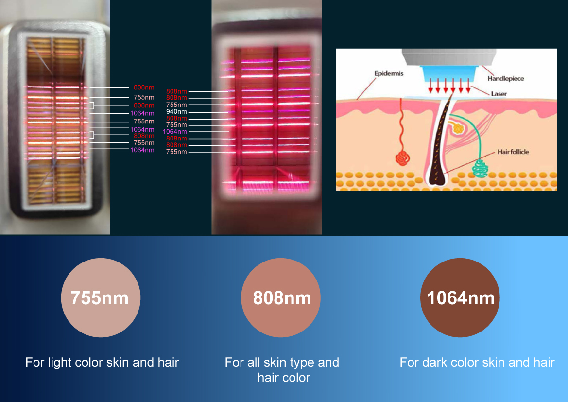 Weifang KM ice Titanium pro multifunction diode laser nd yag laser hair and tattoo removal machine