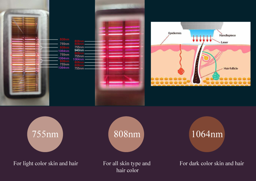 Weifang KM multifunction diode laser Elight SHR nd yag laser RF machine