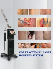Weifang  KM Newest Powerful 70W Co2 Fractional vaginal co2 laser Tightening Beauty Equipment For Sale Co2 Fractional Laser
